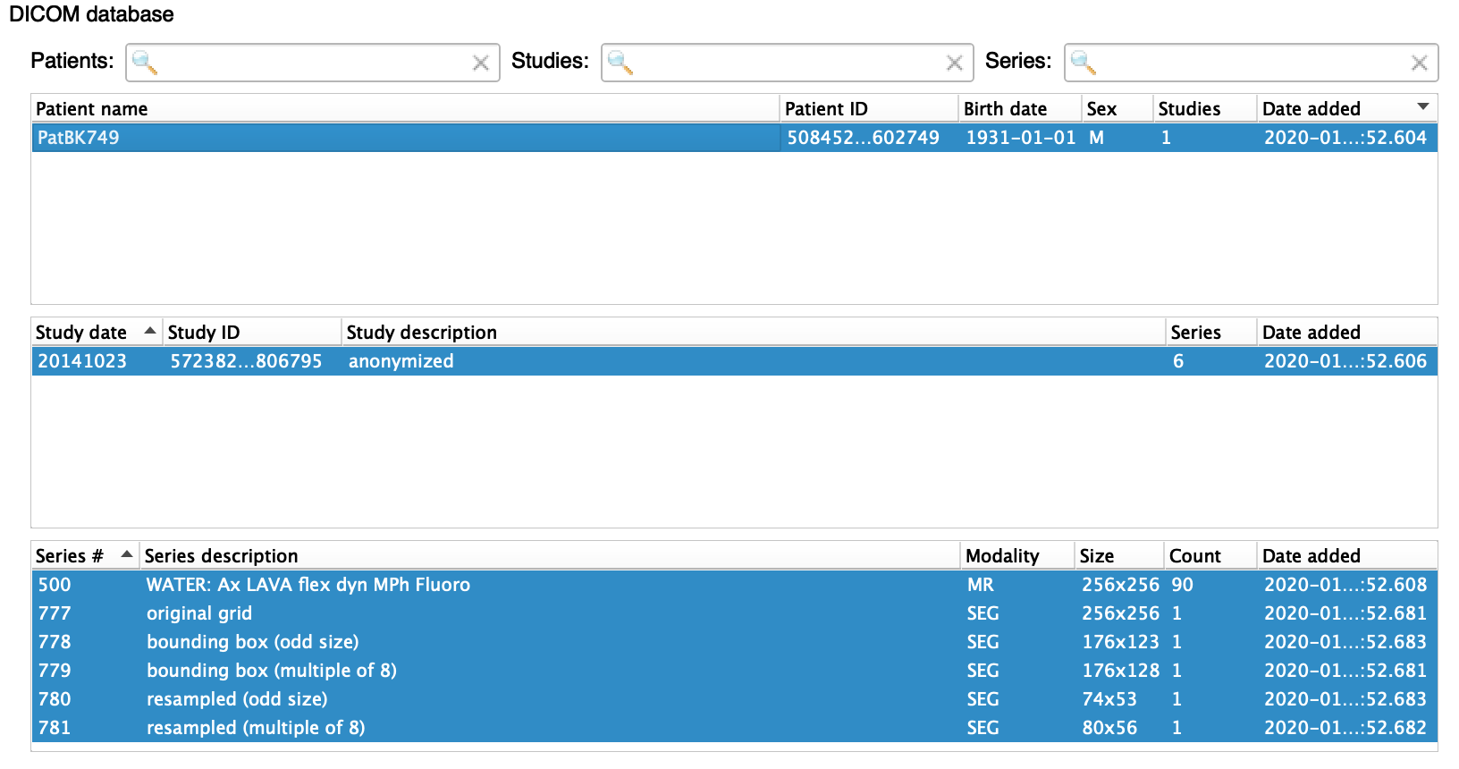 different SEG files listed in CTK DICOM Browser